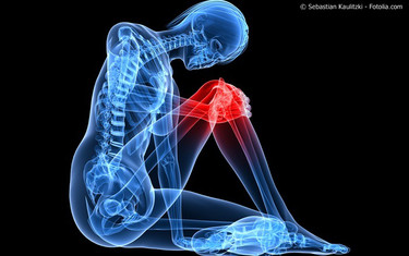 Arthrose bzw. Schmerzen im Knie