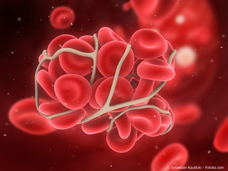 Großaufnahme von geronnenen Blutkörperchen