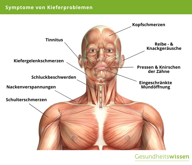Symptome kieferprellung 